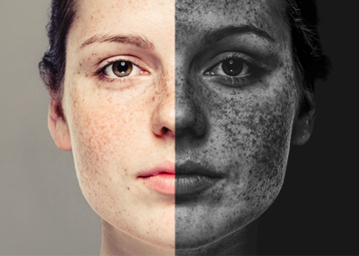 Khói bụi và khí thải ảnh hưởng sâu tới làn da